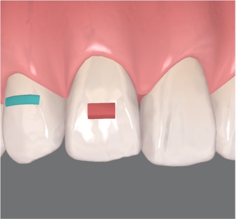 Attachments: todo lo que necesitas saber