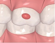 Elipsoidal horizontal