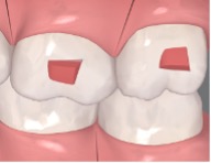 Rectangular horizontal biselado