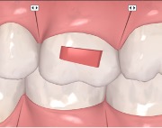 Rectangular horizontal