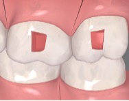 Rectangular vertical biselado