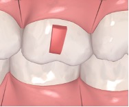 Rectangular vertical