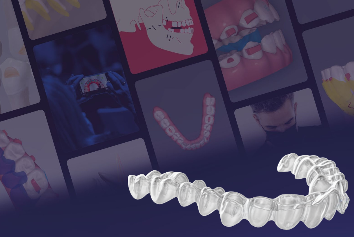 Clear aligner training for orthodontists: what actually moves the needle