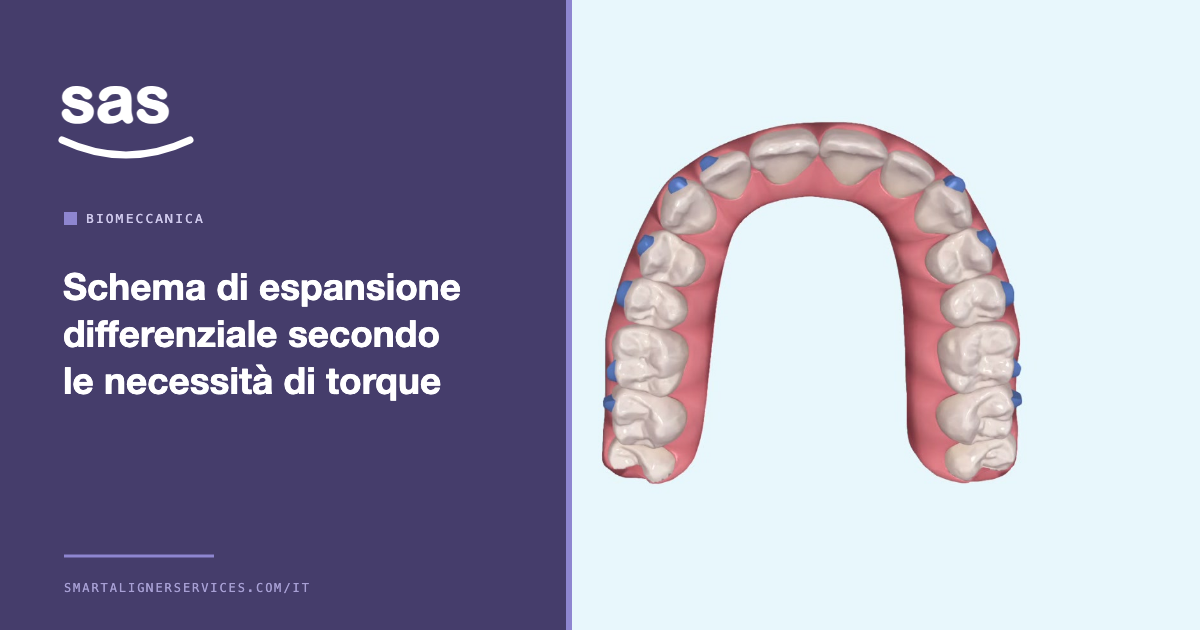 Schema di espansione differenziale secondo le necessità di torque