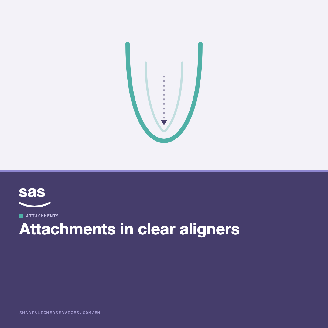 Attachments in clear aligners: what they do and which types matter