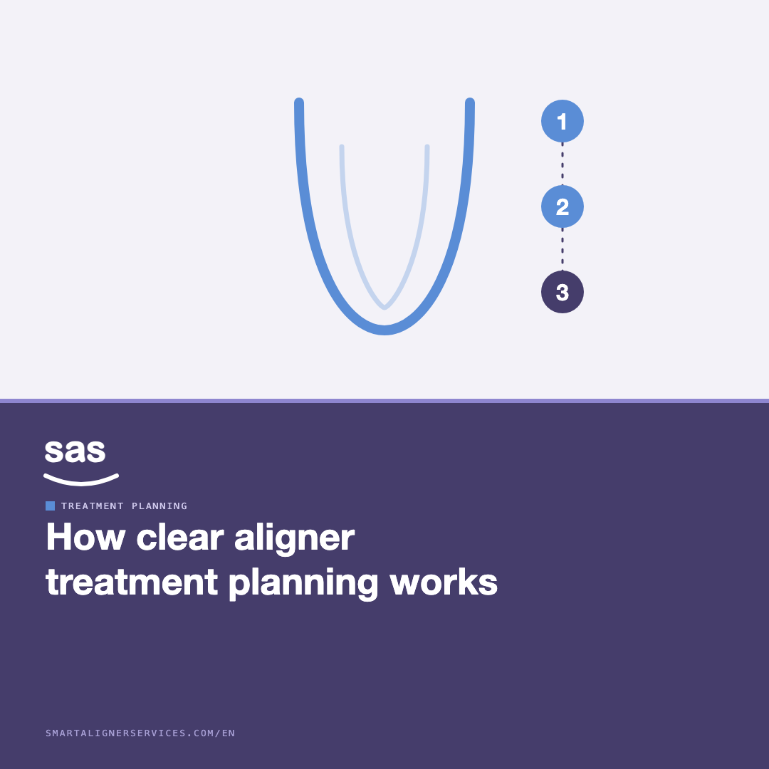 Clear aligner treatment planning: how it works
