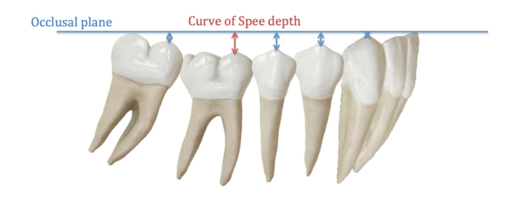 Photo of the spee curve