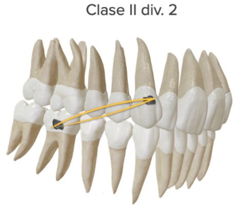 Clase II div 2
